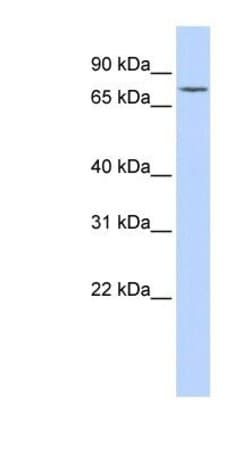 Galactosylceramidase/GALC Rabbit anti-Human, Polyclonal, Novus Biologicals
